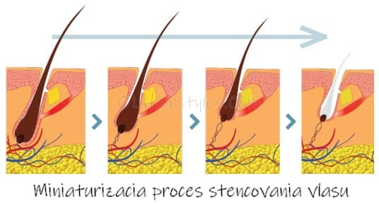 Miniaturizacia proces stencovania vlasu