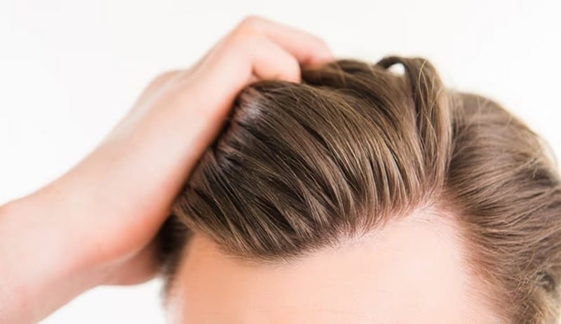 Scalp problems treatment For Men